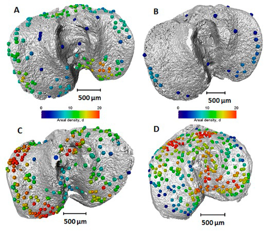 four models of bone joint showing development of bony bridges