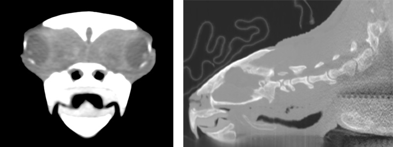 CT scans