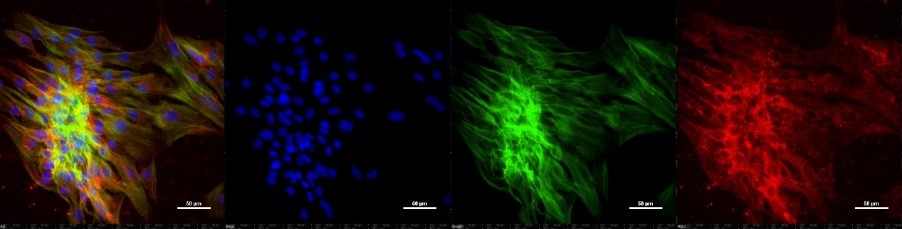 Figure 1: fluorescent images showing merged, dapi, phalloidin and P65 antibodies staining of inhibitor 1 and all three cytokines stimulated adult tendon cells.