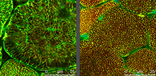 micrograph slides of muscle tissue