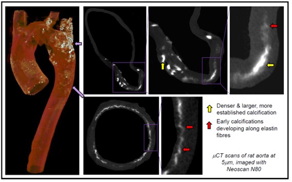 radiographs of normal and knockout mice skeletons showing regions of calcification