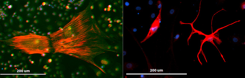 induced pluripotent stem cells