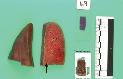 Biopsy samples