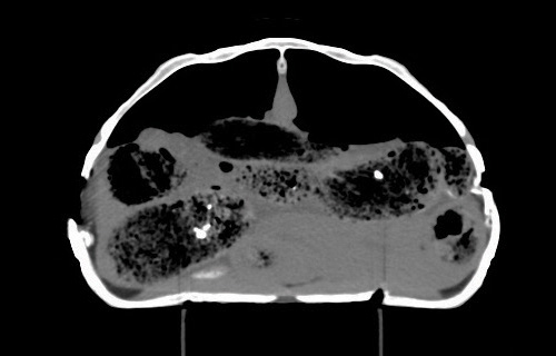 CT scan of damaged tortoise shell